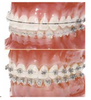 ortodoncia2
